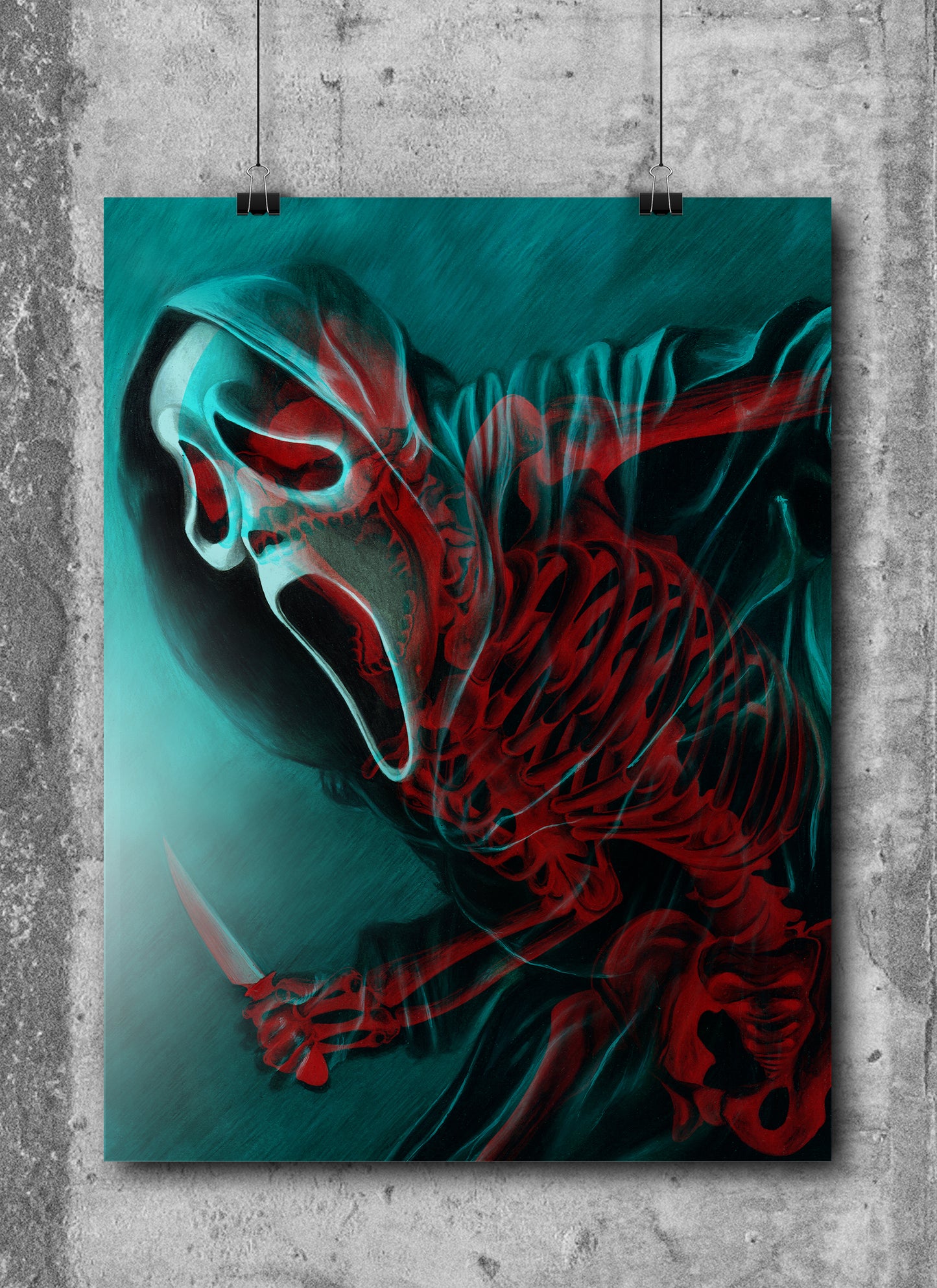 WE ALL GO A LITTLE MAD SOMETIMES | X-Ray