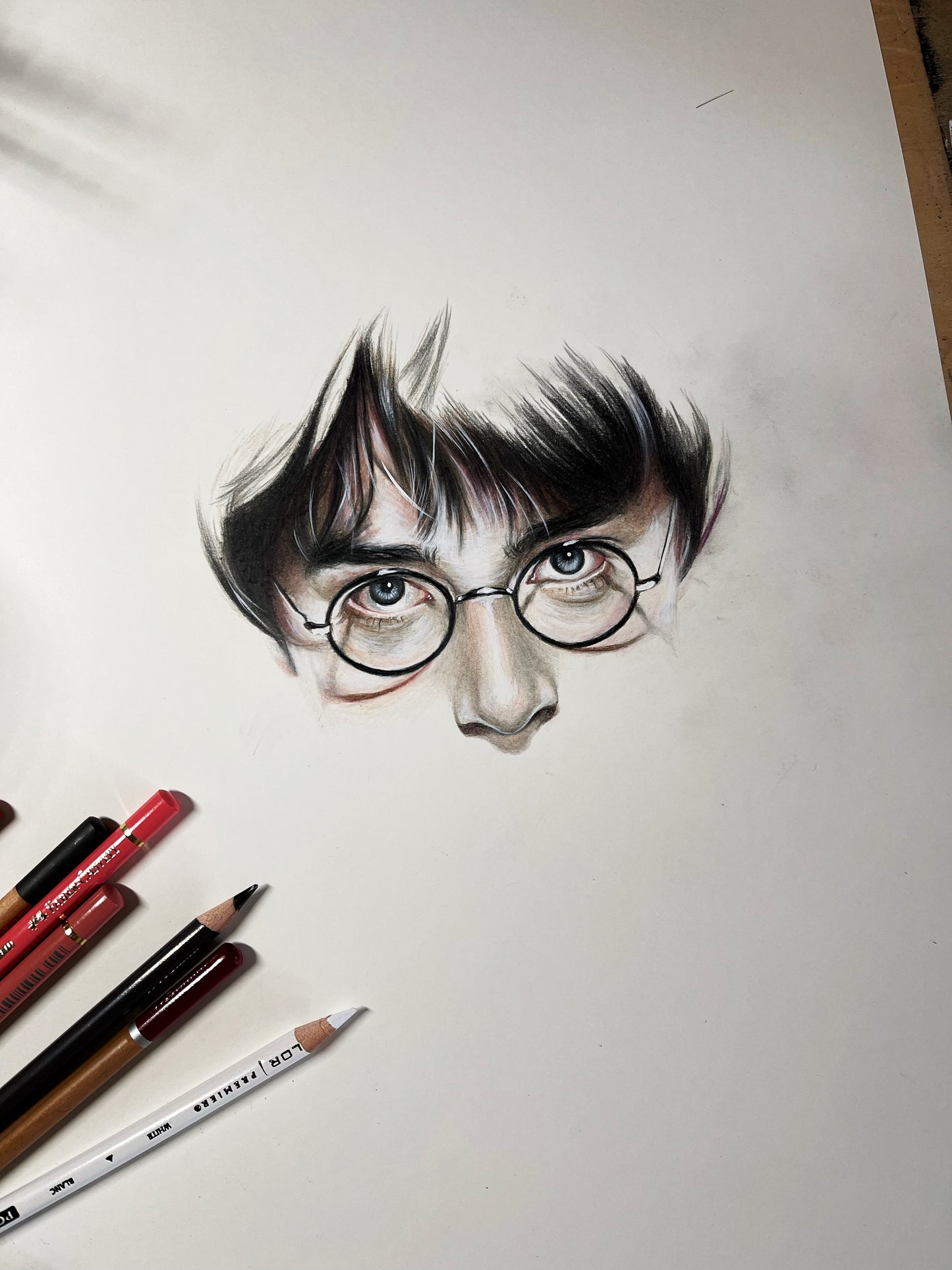 THE BOY WHO LIVED | X-Ray